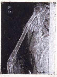 Loading Picture